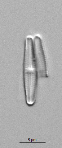 Achnanthidium jackii image