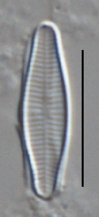 Image of Achnanthidium eutrophilum