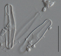 Image of Achnanthidium reimeri