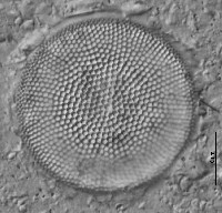 Actinocyclus normanii image