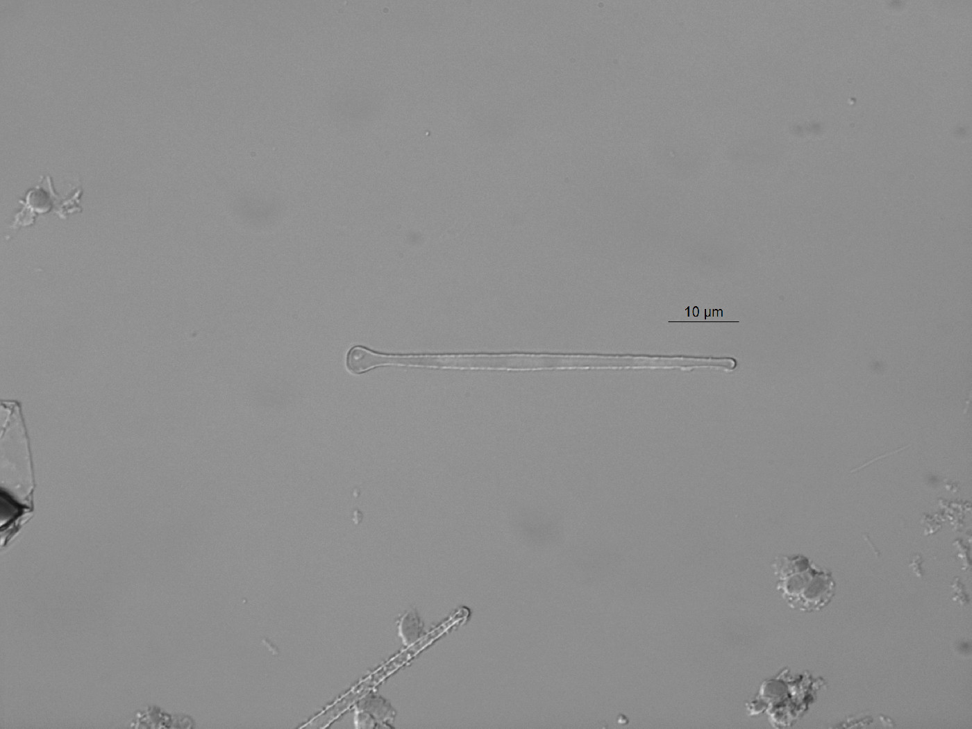 Asterionella formosa image