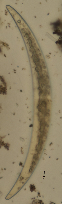 Image of Closterium dianae