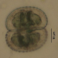 Cosmarium punctulatum var. subpunctulatum image