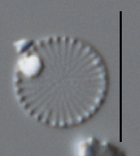 Image of Cyclostephanos invisitatus