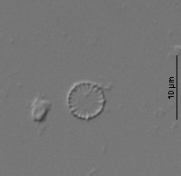 Cyclotella atomus image