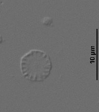 Cyclotella atomus image