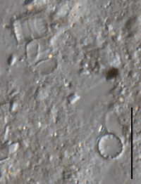 Image of Cyclotella atomus