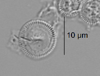 Image of Cyclotella distinguenda