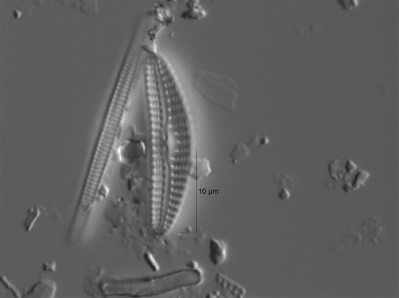 Cymbella botellus image