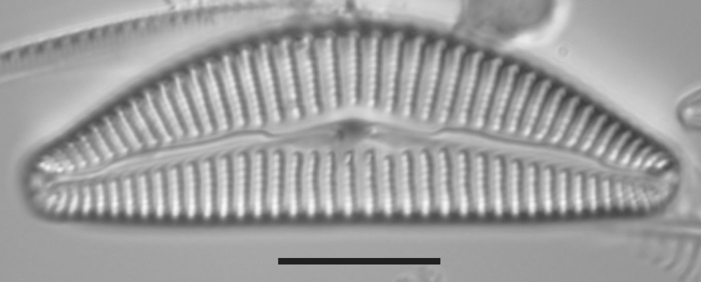 Cymbella subturgidula image