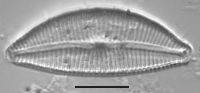 Cymbella turgidula image