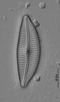 Cymbella turgidula image