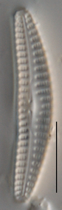 Image of Cymbella botellus