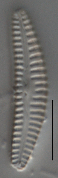 Cymbella botellus image