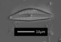 Cymbella leptoceros image
