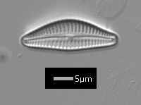 Image of Cymbella leptoceros