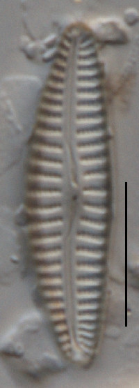 Image of Cymbella neoleptoceros