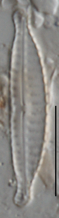 Image of Cymbella schubartoides