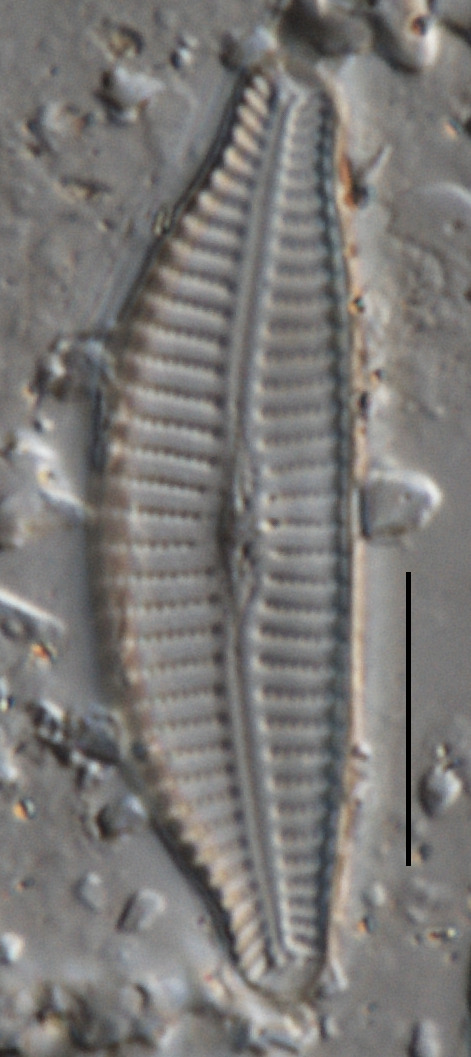 Cymbella subturgidula image