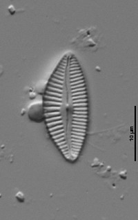Image of Cymbopleura rhomboidea
