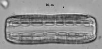 Image of Denticula valida