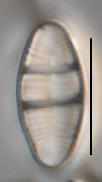 Image of Odontidium mesodon