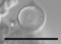 Image of Discostella pseudostelligera