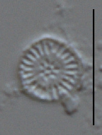 Image of Discostella stelligera