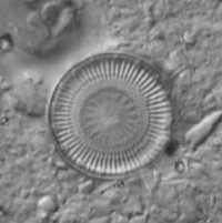 Image of Discostella asterocostata