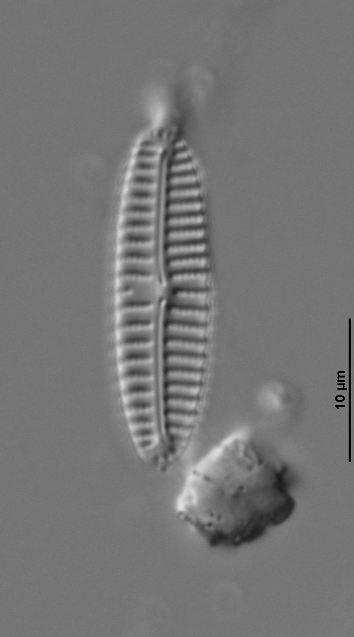 Encyonema appalachianum image