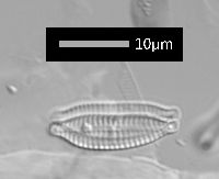 Encyonema rostratum image