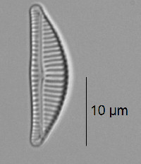 Encyonema silesiacum image