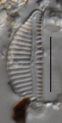 Encyonema ventricosum image