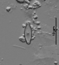Encyonopsis microcephala image