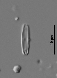 Encyonopsis microcephala image