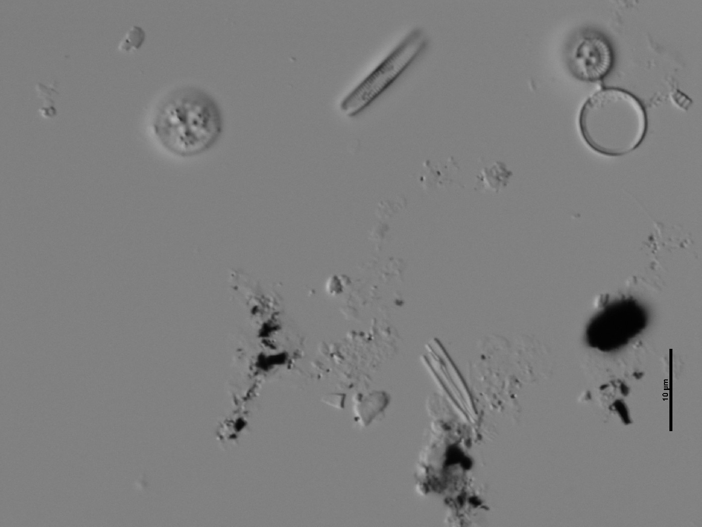 Encyonopsis image