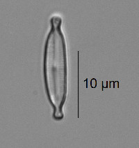 Image of Encyonopsis minuta
