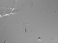 Encyonopsis subminuta image