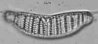 Image of Epithemia adnata