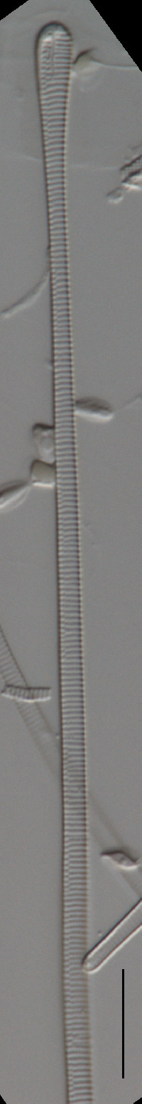 Eunotia eurycephala image