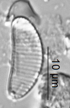 Eunotia scandiorussica image