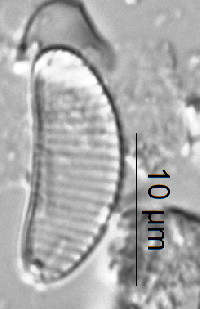 Image of Eunotia scandiorussica