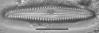 Image of Gomphonema caperatum