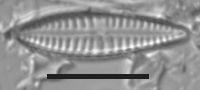Image of Gomphonema insigniforme