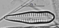 Image of Gomphonema angusticephalum