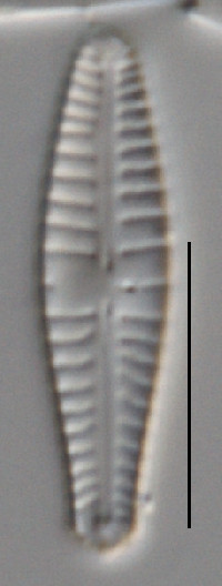 Image of Gomphonema angustum