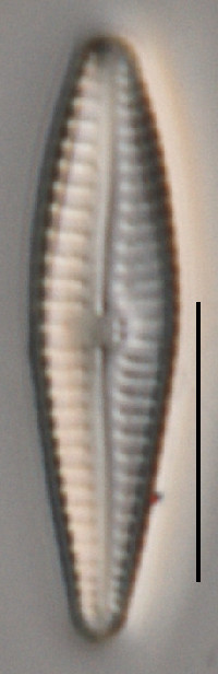 Image of Gomphonema bipunctatum