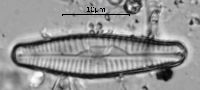 Image of Gomphonema cymbelliclinum
