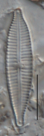 Gomphonema exilissimum image