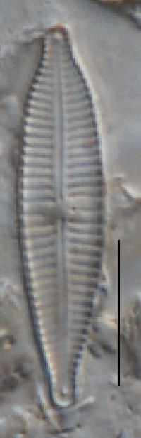 Image of Gomphonema exilissimum